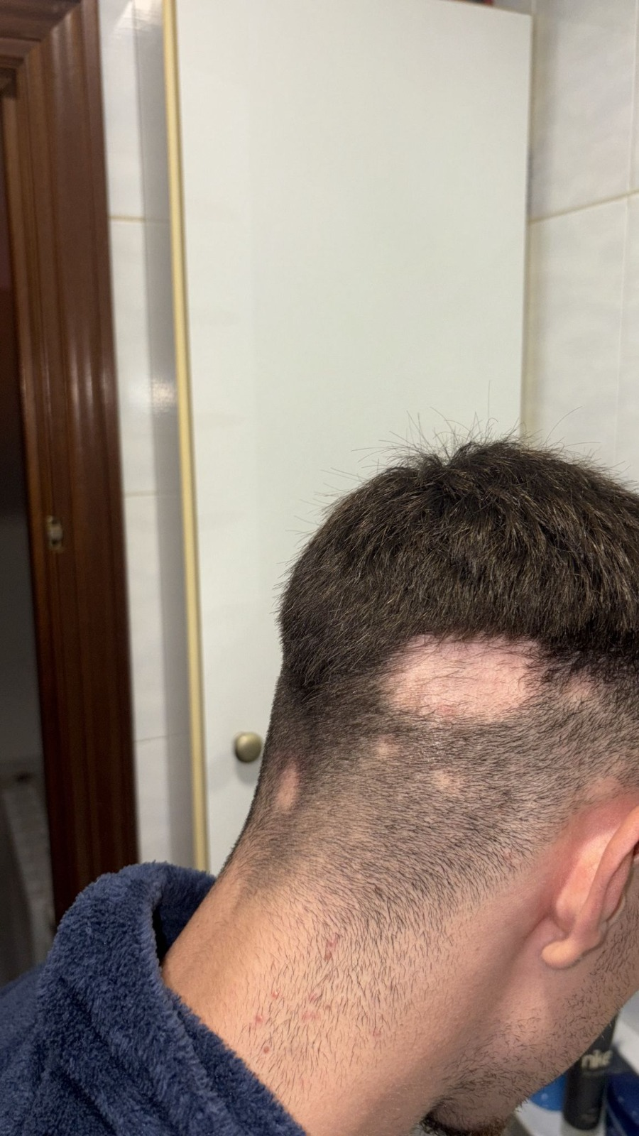 Antes 1